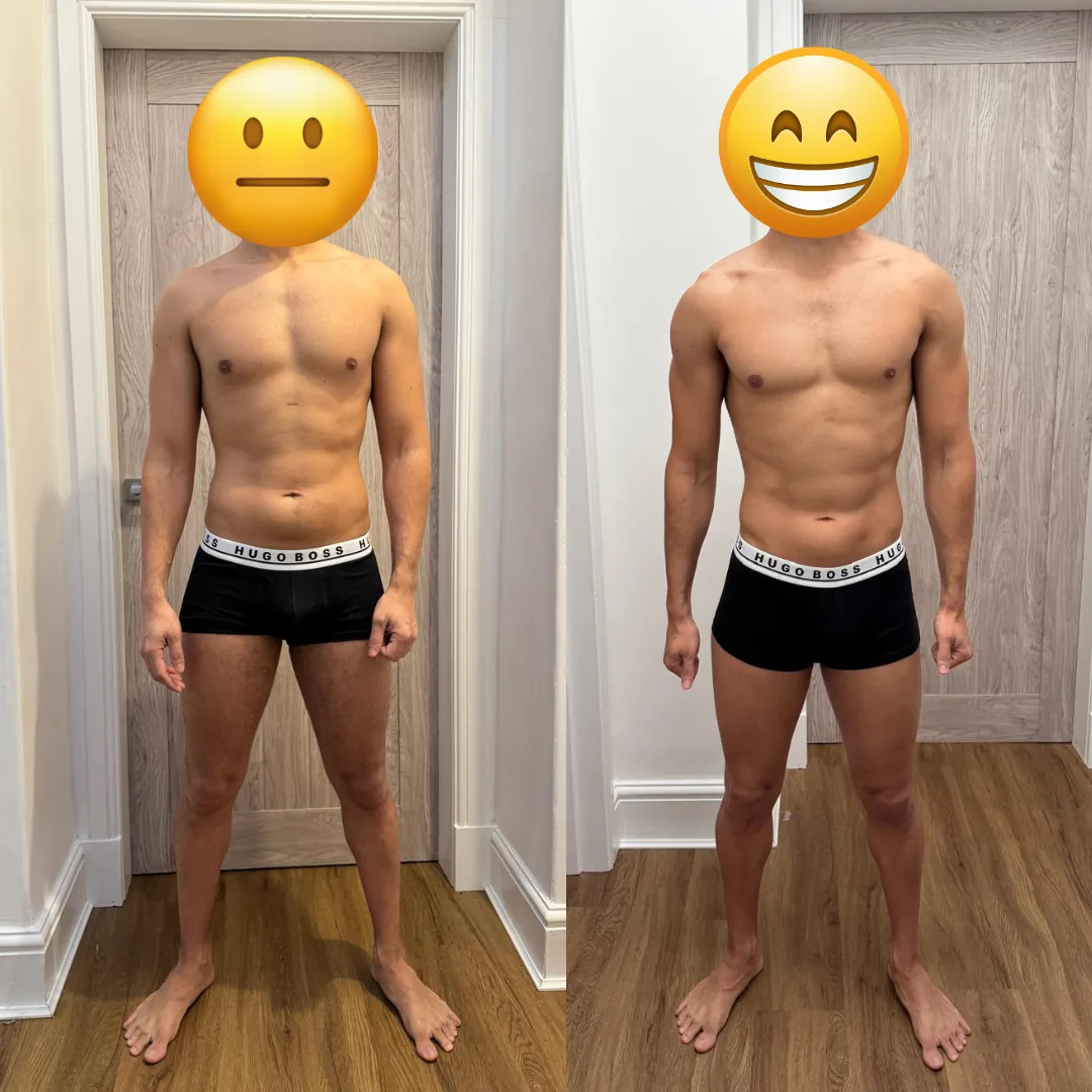 Antes e depois — Hipertrofia